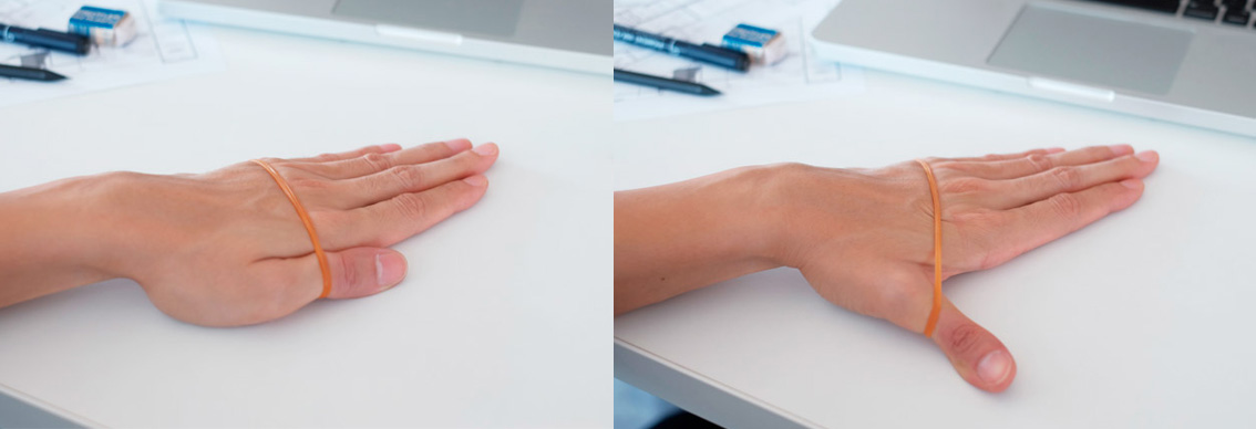 Banyak Kerja di Laptop? Lakukan 10 Olahraga Tangan Ini