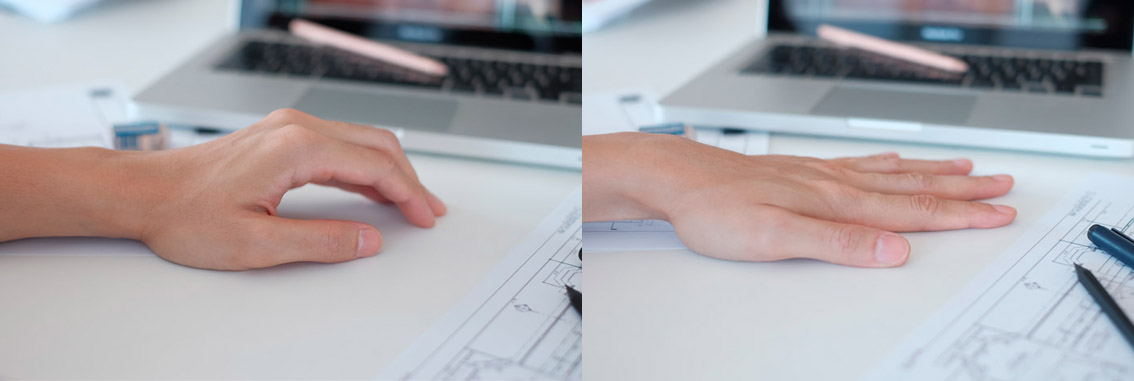 Banyak Kerja di Laptop? Lakukan 10 Olahraga Tangan Ini